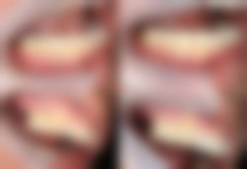 湖南衡阳耒阳博雅口腔技术设备怎么样？