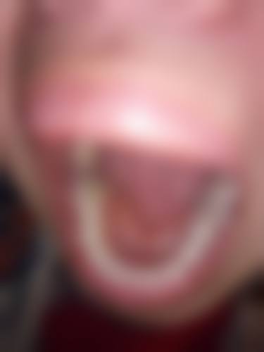 广东惠州正桥口腔擅长项目有哪些?