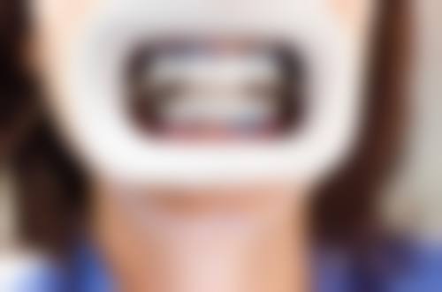 东莞任煜光口腔门诊部技术设备怎么样？