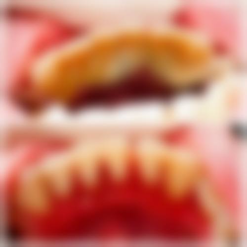 云南施甸博盛口腔医生团队解析