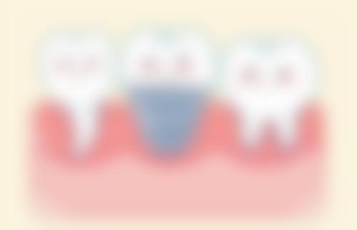 惠州正心口腔(东平店)医生团队解析