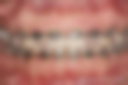 四川成都一牙桔子口腔连锁口碑评价