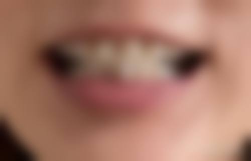 四川成都一牙桔子口腔连锁服务特色