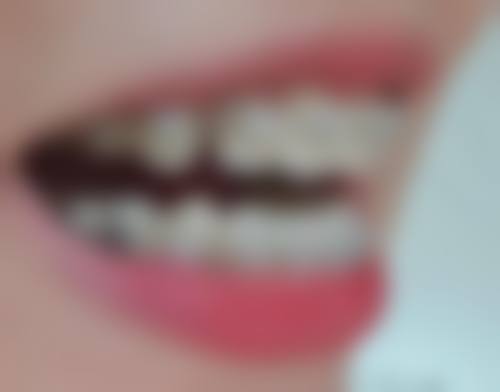 四川成都一牙桔子口腔连锁技术设备怎么样？