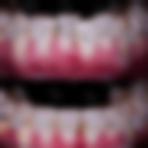 四川成都一牙桔子口腔连锁擅长项目有哪些？