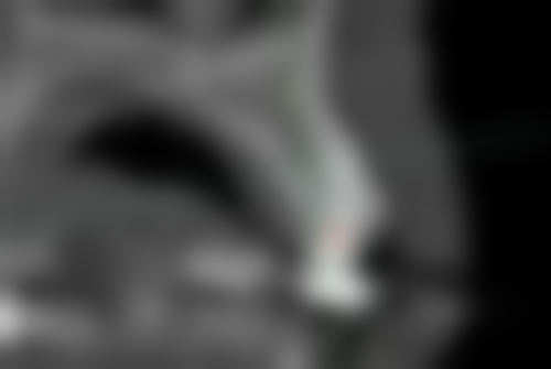 莆田市荔城区领跑口腔诊所擅长项目有哪些？