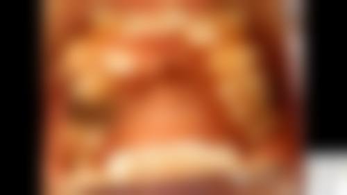 湖南常德武陵镇杨玮口腔诊所擅长项目有哪些？