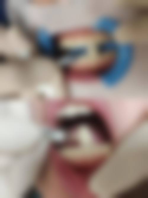 樟树徐良口腔门诊部2026价格表参考