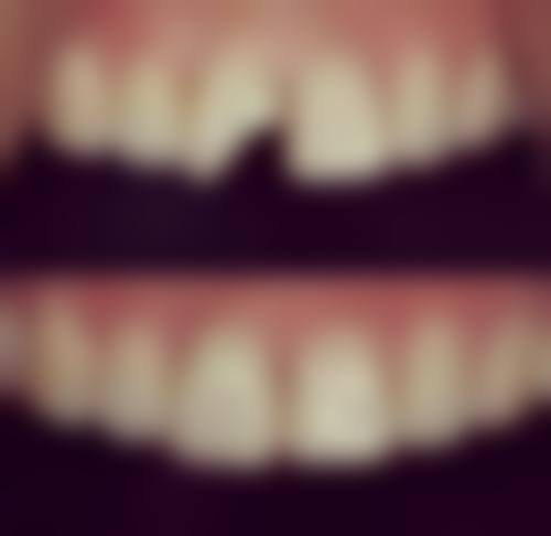 维尔口腔三元桥总院医生团队解析