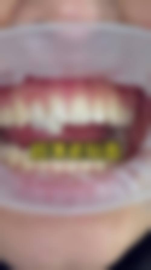 广东惠州精英惠口腔门诊口碑评价