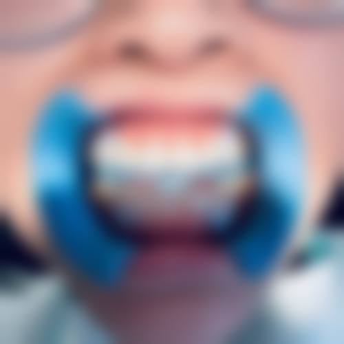 重庆渝中瑞泰口腔(久悦口腔解放碑英利门诊)技术设备怎么样?