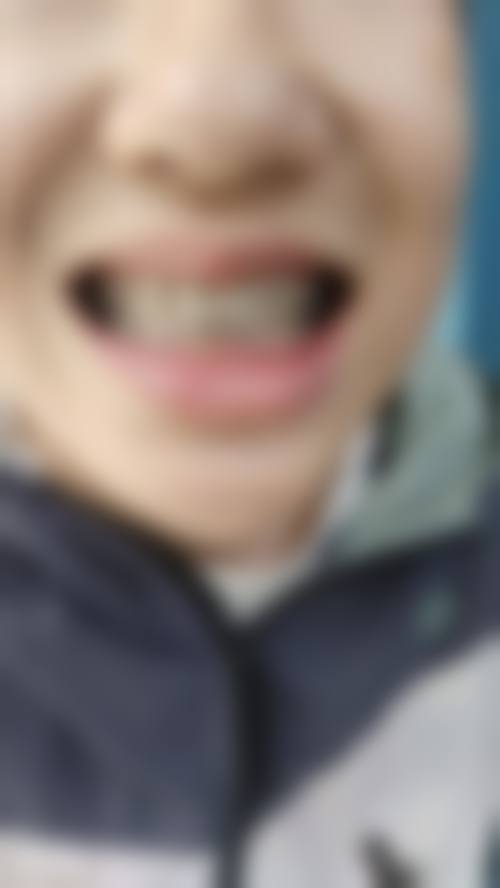 王翠预约方式及价格表