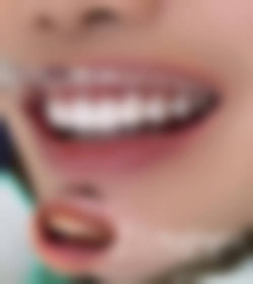 王翠患者评价