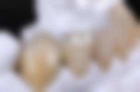 湖南永州天成口腔擅长项目有哪些?