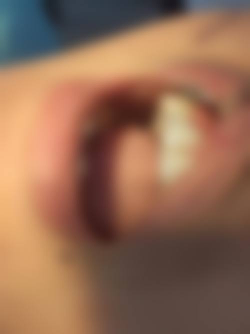 【洛阳王城医院真实口碑评价】