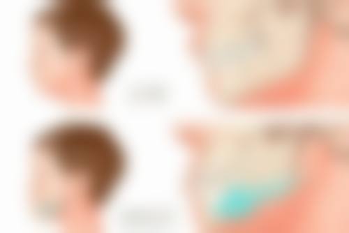 【杭州修元口腔预约挂号方式】