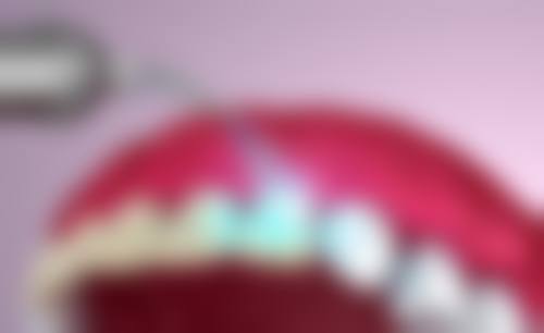 【杭州修元口腔真实口碑评价】