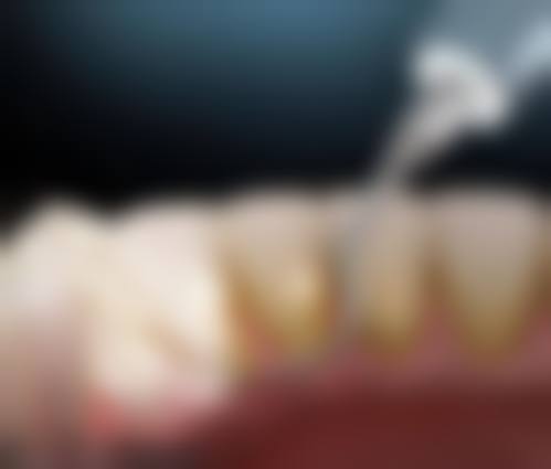 【哈尔滨香坊丁香花口腔门诊部常见问题解答】