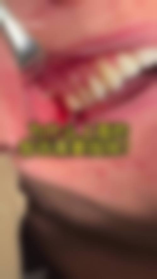 【福州维乐口腔儿牙门诊(台江茶亭店)特色诊疗项目】