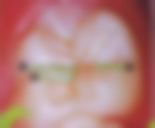 【云南普洱墨江博时口腔特色诊疗项目】