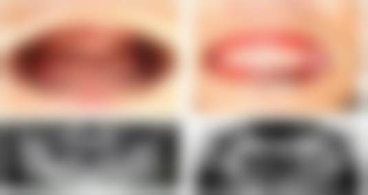 【南京美奥口腔门诊部真实口碑评价】