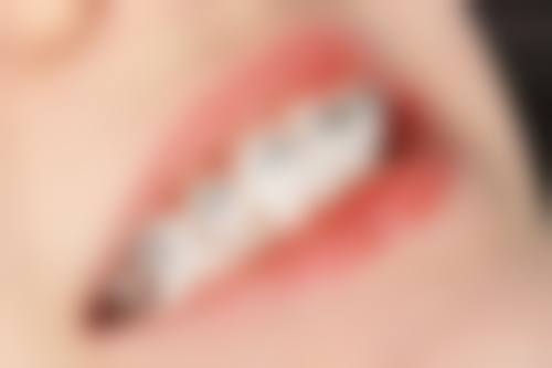 【陕西渭南致成固德口腔医院价格表参考】