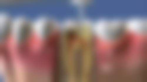 【江西宜春丰城微笑口腔特色诊疗项目】