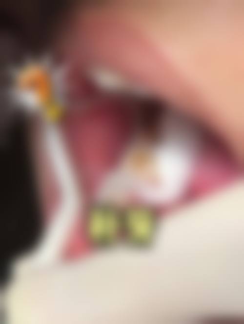 【汕尾陆丰市林海洲口腔诊所预约挂号方式】