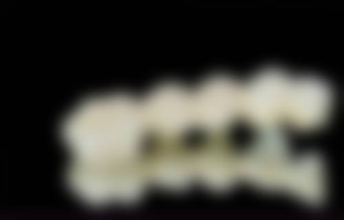 【深圳美佳口腔门诊部价格表参考】
