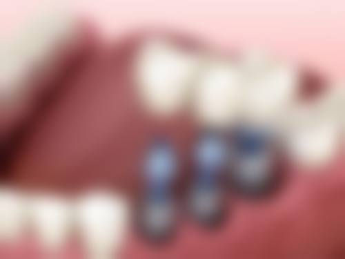 陈良技术水平评价