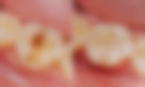 【山东青岛皓典口腔价格表参考】