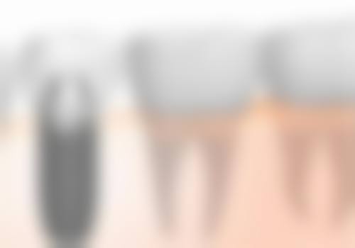 【成都可斐口腔诊所骨干医生团队与技术标准】