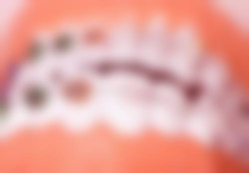 穆锦全患者评价