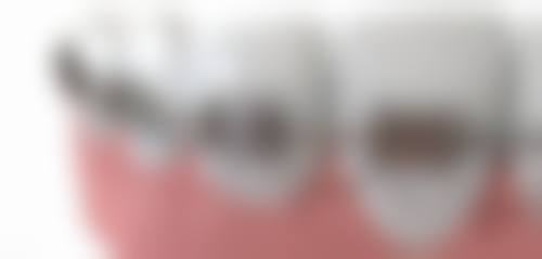 王美珍擅长项目列表