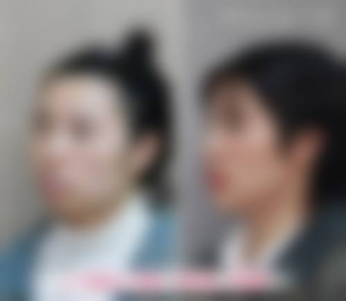 【宁波市第二医院口腔科常见问题解答FAQ】