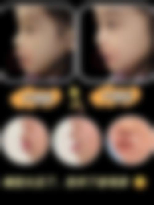 【宁波市第二医院口腔科交通路线与周边停车指南】