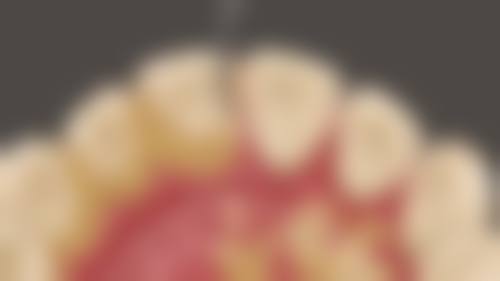【秦皇岛纳极口腔门诊部真实口碑评价】