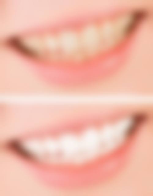 【爱千齿口腔门诊部前列技术设备与院感环境】