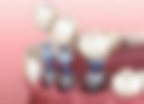 【8020口腔医院参考价格表】