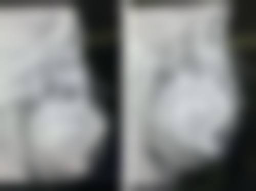 【广东东莞天悦口腔参考价格表】