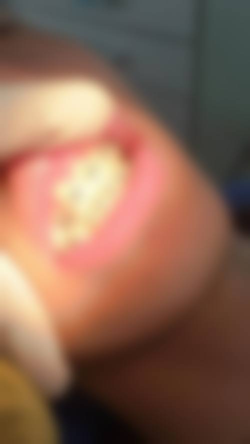 【广东东莞天悦口腔特色诊疗项目】