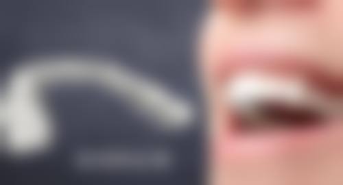【江苏南京苏齿口腔真实口碑评价】