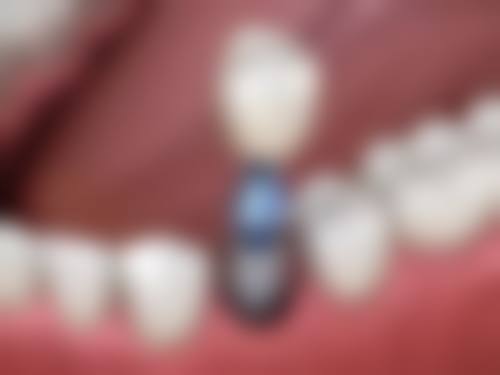 【云南丽江永胜吉星国口腔预约挂号方式与流程】