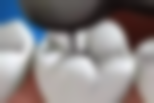 【阳泉康贝口腔医院骨干医生团队与技术标准】