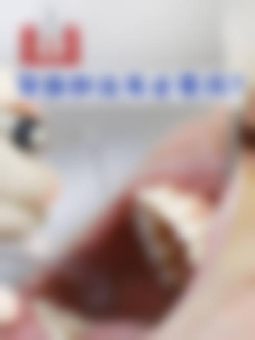 【肇庆国美口腔门诊部常见问题解答FAQ】