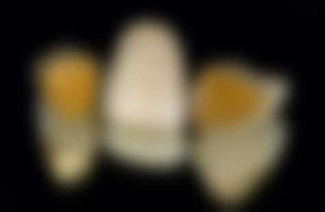 【诺贝加尔口腔门诊部真实口碑评价】