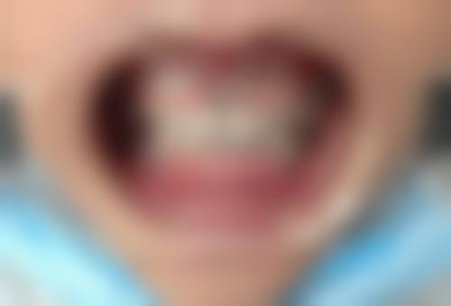 【沈阳好物口腔参考价格表】