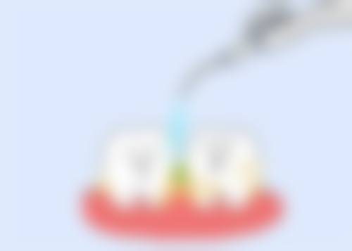 【深圳斯美奥口腔诊所骨干医生团队与技术标准】