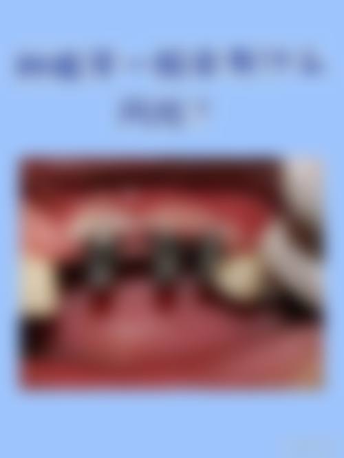 【深圳斯美奥口腔诊所常见问题解答FAQ】