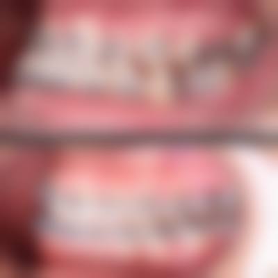 【佛山顺德大良牙管家口腔门诊部特色诊疗项目】